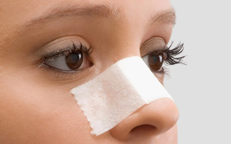 آموزش زدن چسب بینی پس از عمل و دلایل آن